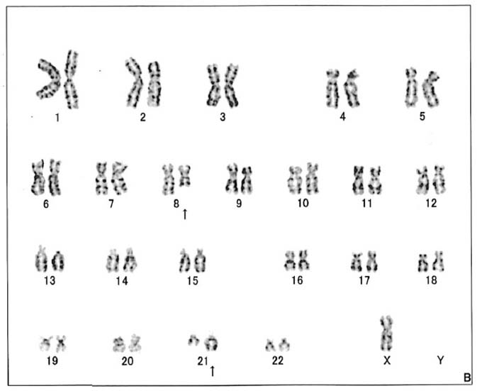 t-8-21-minusY.jpg