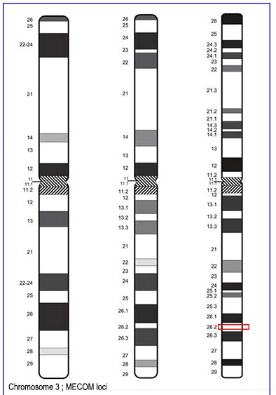 chromosome3-MECOM loci.jpg