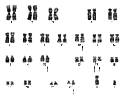 karyotype03.jpg