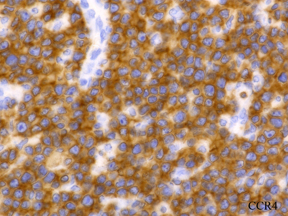 CCR4-Toume.jpg