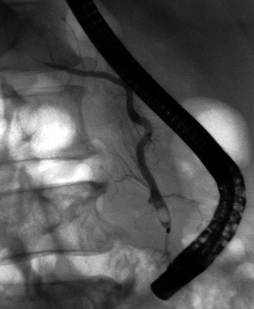 ERCP01.jpg