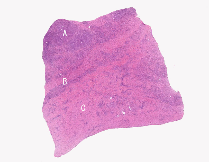 panc01a.jpg
