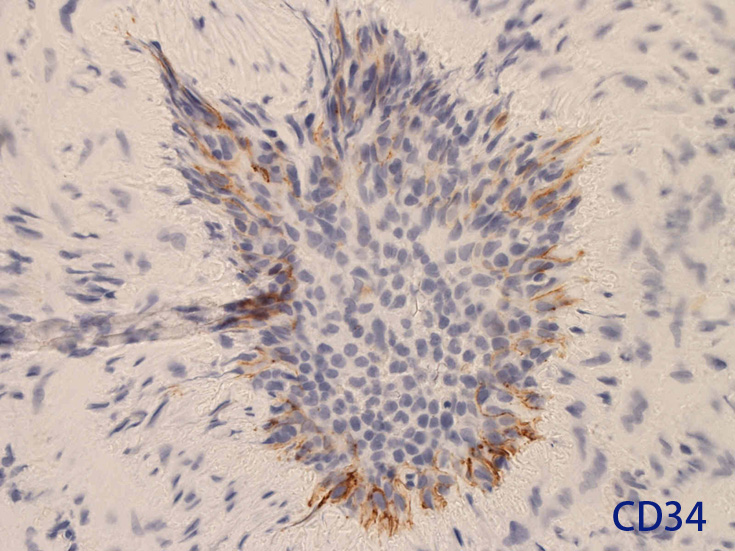 CD34.jpg