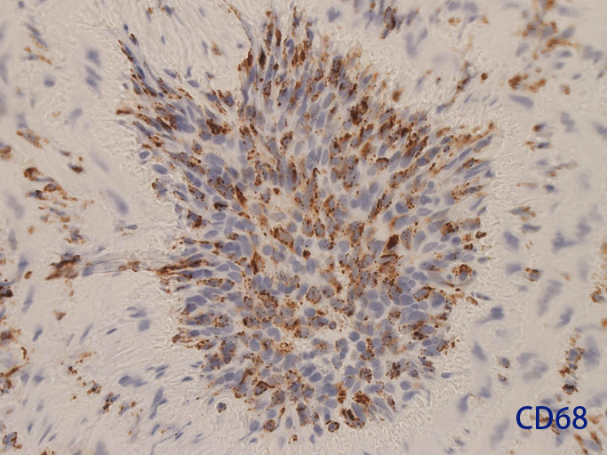CD68hpf.jpg