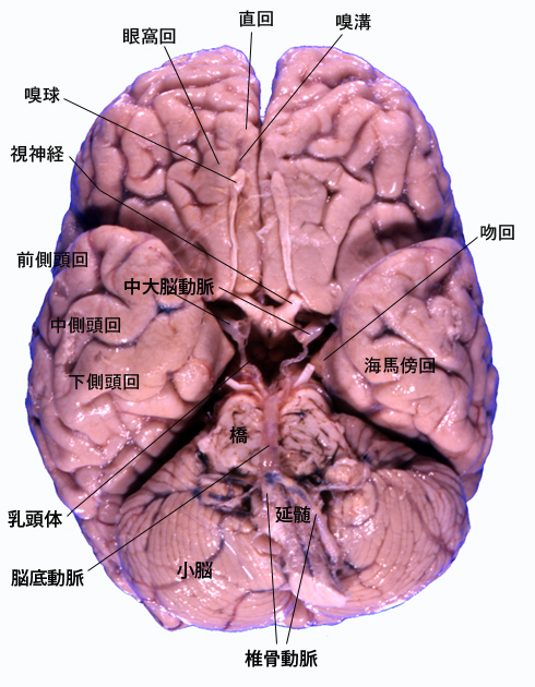 brainbase01.jpg