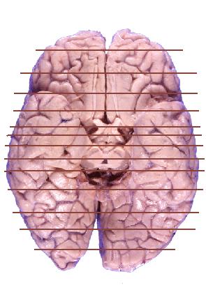 brainbasecut.gif