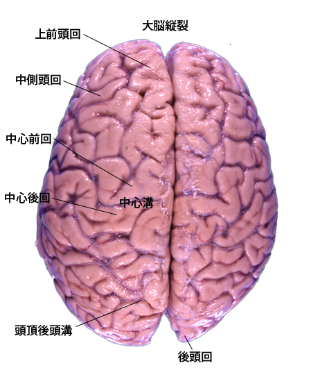 braintop01.jpg
