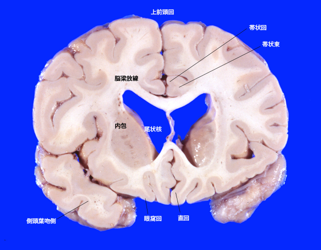 caudatenuclei01.jpg