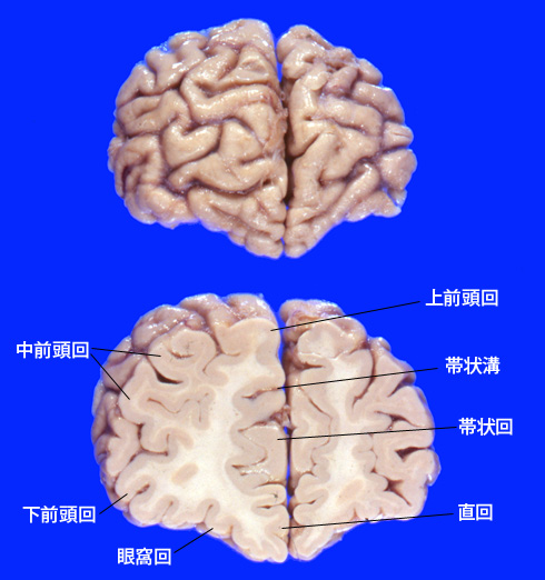 frontallobe01.jpg