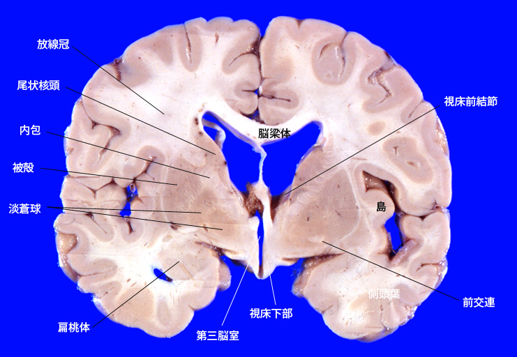 hypothalamus01.jpg