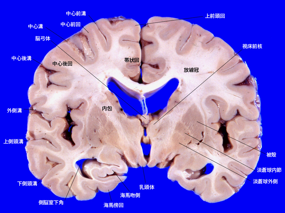 mammarybody02.jpg