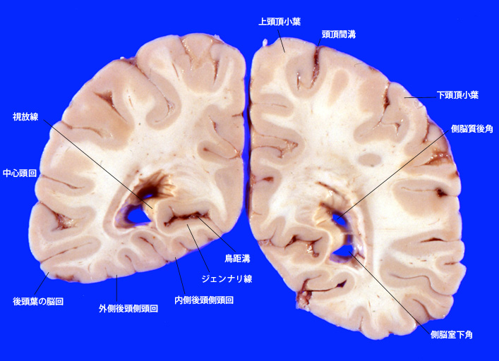 occipital04.jpg