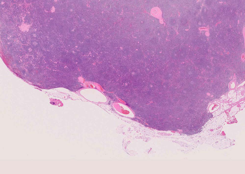 Sai-H2202551_vascular dilatationOK.jpg