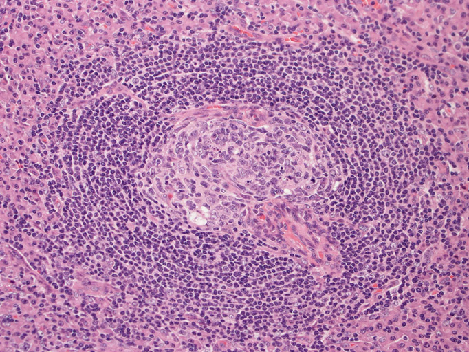 follicle03.jpg