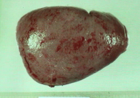 spleen01.jpg