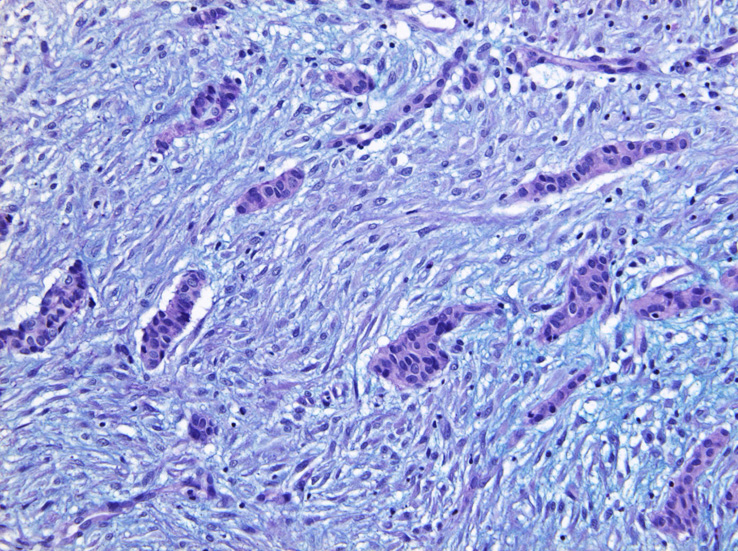 AB02.jpg