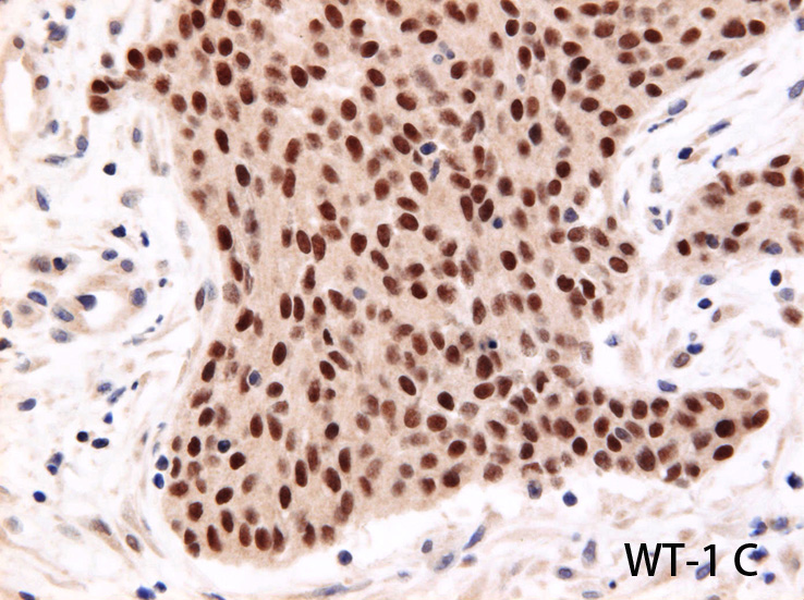 WT-1C01.jpg