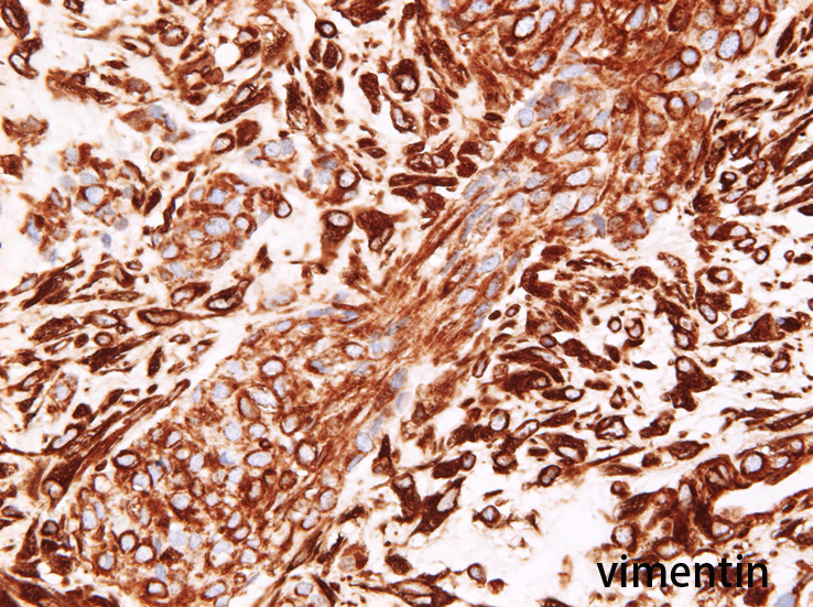 vimentin02.jpg
