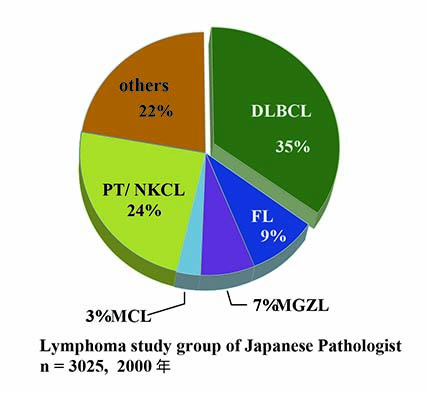 DLBCL35.jpg