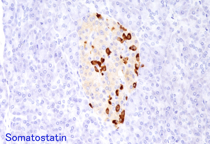 somatostatin02.jpg