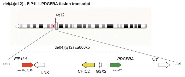 FIP1L1-PDGFRA-CEL.jpg