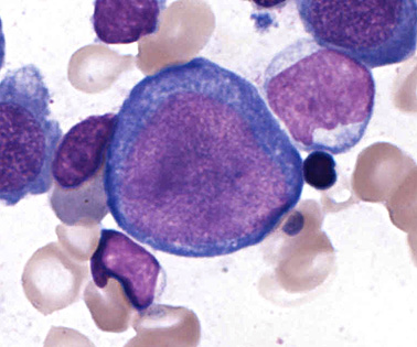 erythroblast.jpg