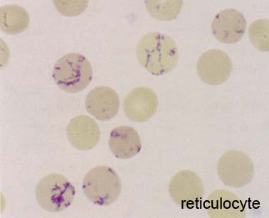 reticulocyte.jpg