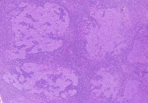 Follicles with floral pattern.jpg