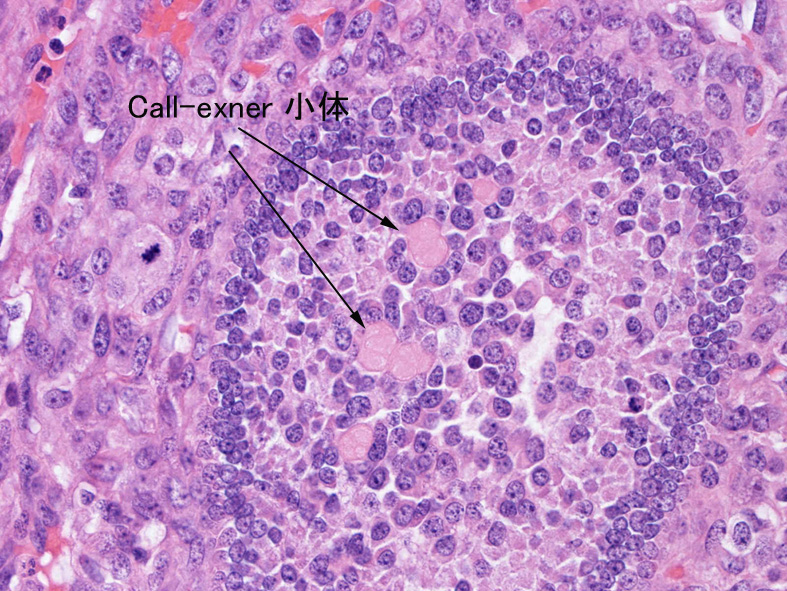 callexner.jpg