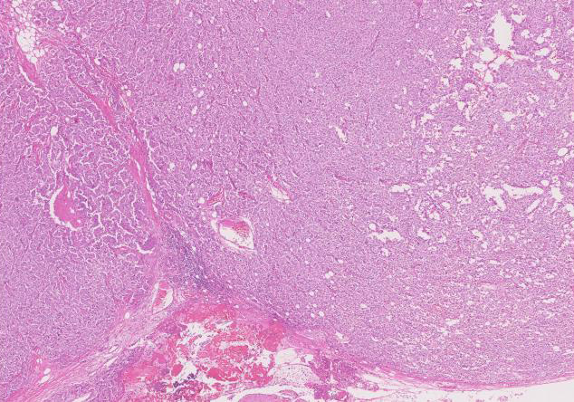 FDC-case01.jpg