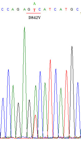 PDGFRA_D842Vmutation.jpg