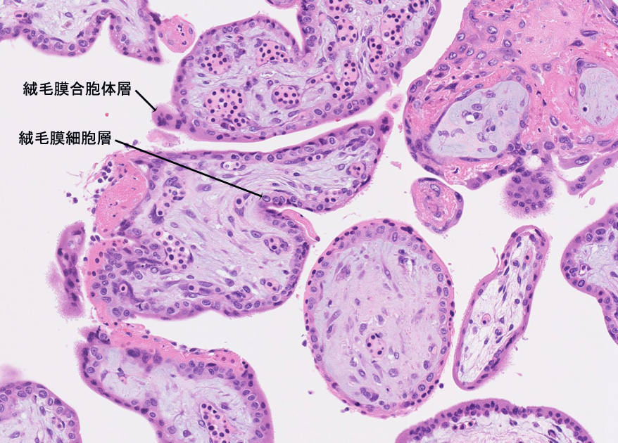 villi01.jpg