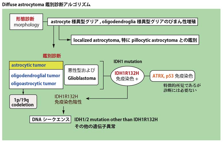 diffuseastrocytomaDDx.jpg