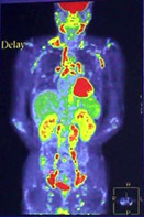 case01PET.jpg
