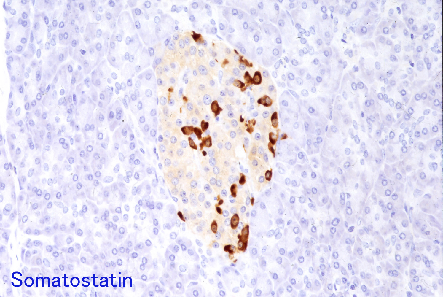 somatostatin01.jpg