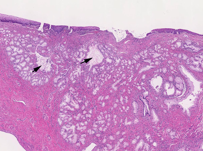 LEGHlobule01.jpg