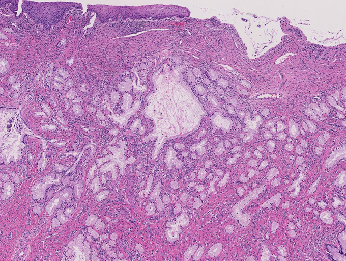 LEGHlobule02.jpg