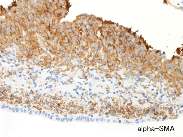 alphaSMA.jpg