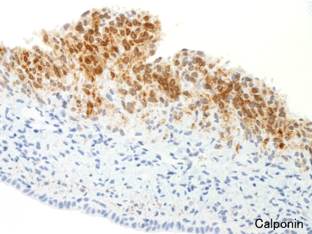 calponin.jpg
