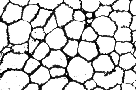 Hypo-diffuse_MDS.jpg