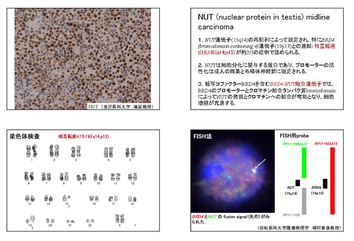 NUT04.jpg
