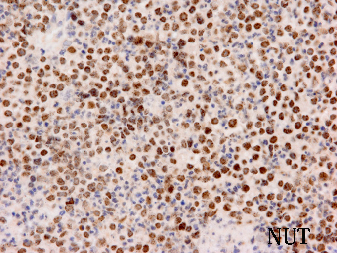 NUTihc01.jpg
