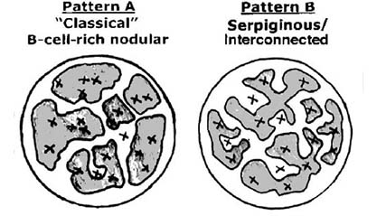 NLPHL-patternA.jpg