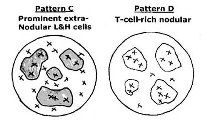 NLPHL-patternB.jpg
