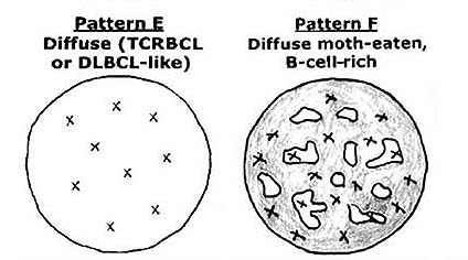 NLPHL-patternC.jpg