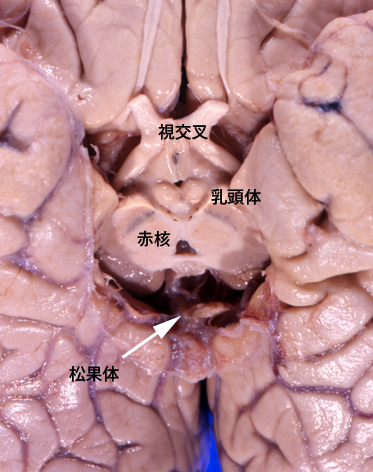 pinealbody01.jpg