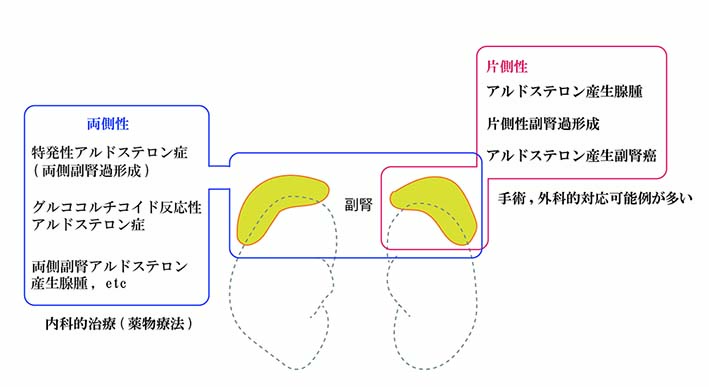 bi-uni-lateral-lesions.jpg