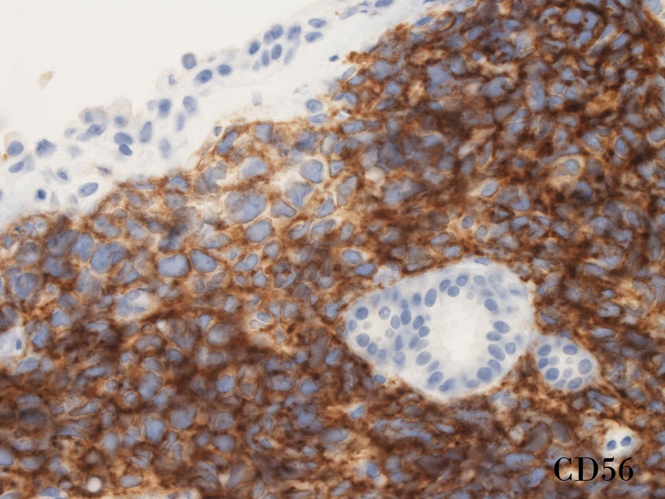 CD56.jpg