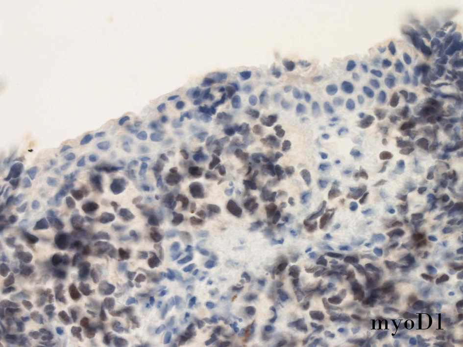 myoD1-01.jpg