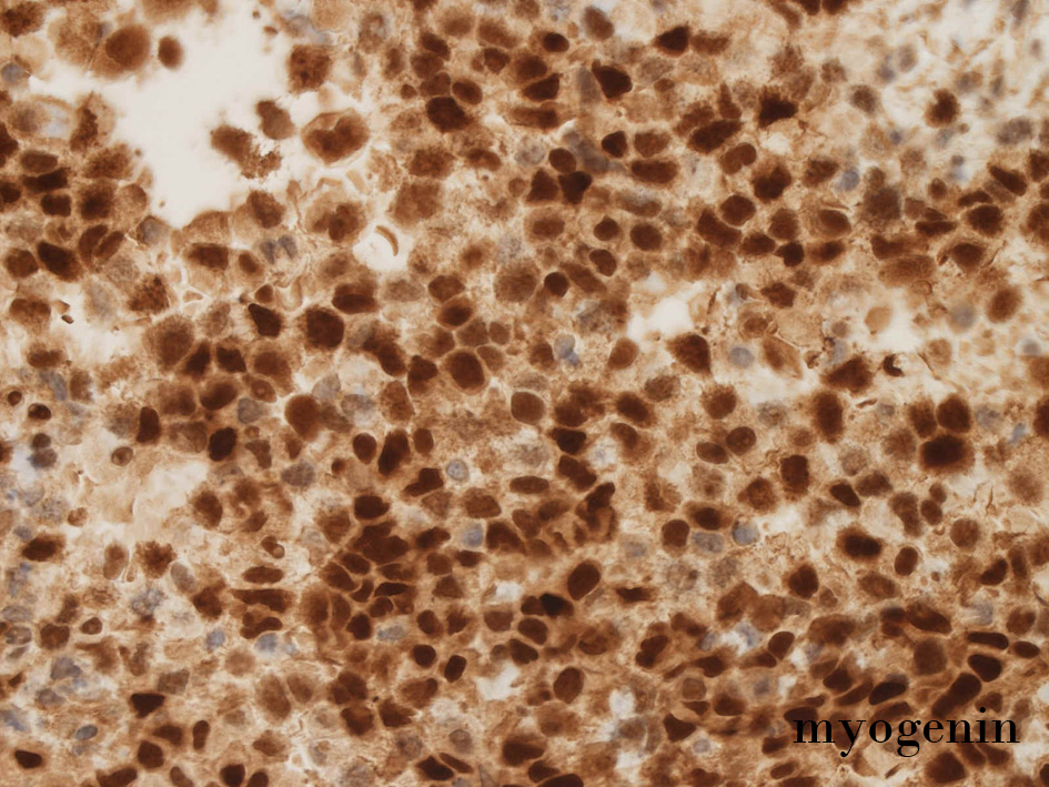 myogenin_02.jpg
